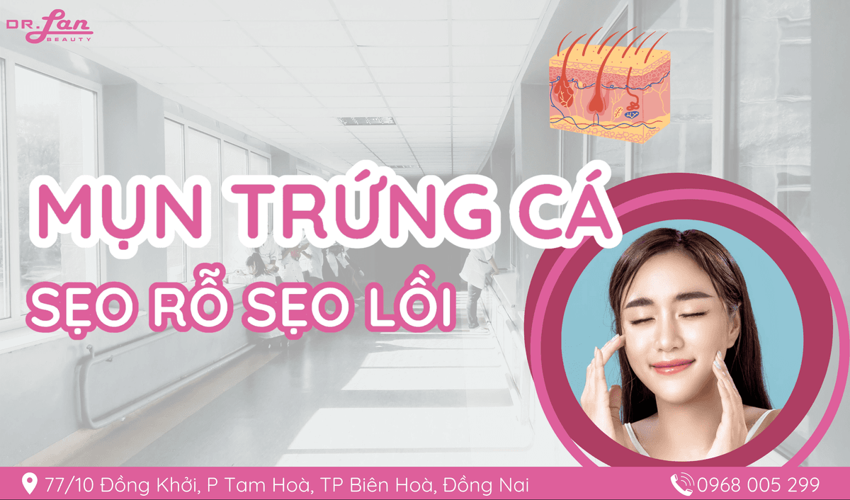Điều Trị Mụn Trứng Cá, Sẹo Rỗ, Sẹo Lồi Dứt Điểm, An Toàn, Hiệu Quả