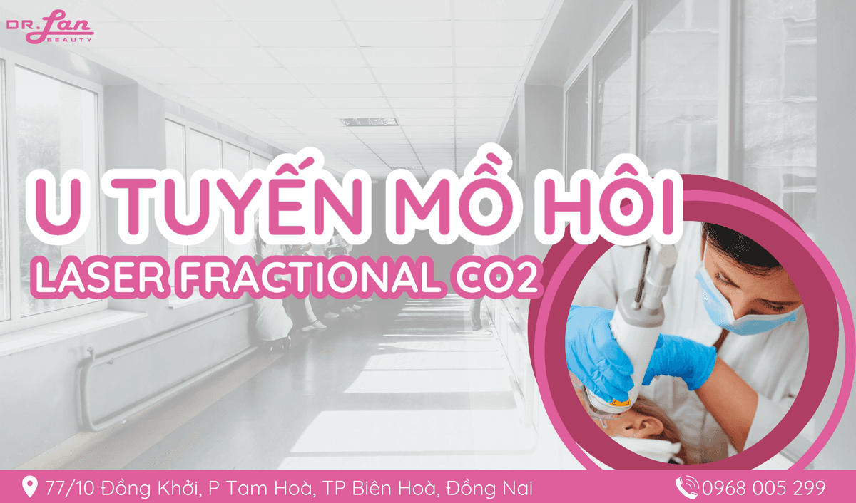 Điều Trị U Tuyến Ống Mồ Hôi An Toàn, Hiệu Quả