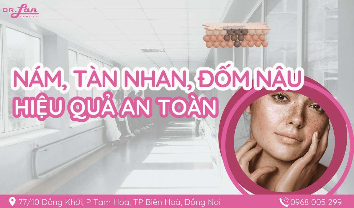 Điều Trị Nám, Tàn Nhan, Đốm Nâu Hiệu Quả An Toàn.