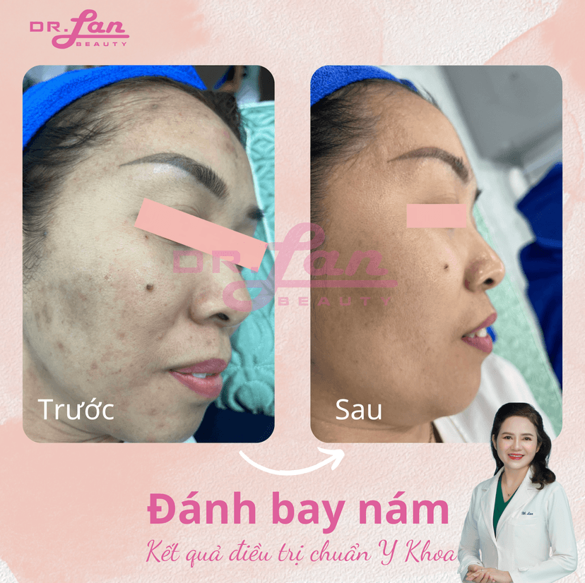 Uống đúng và đủ nước