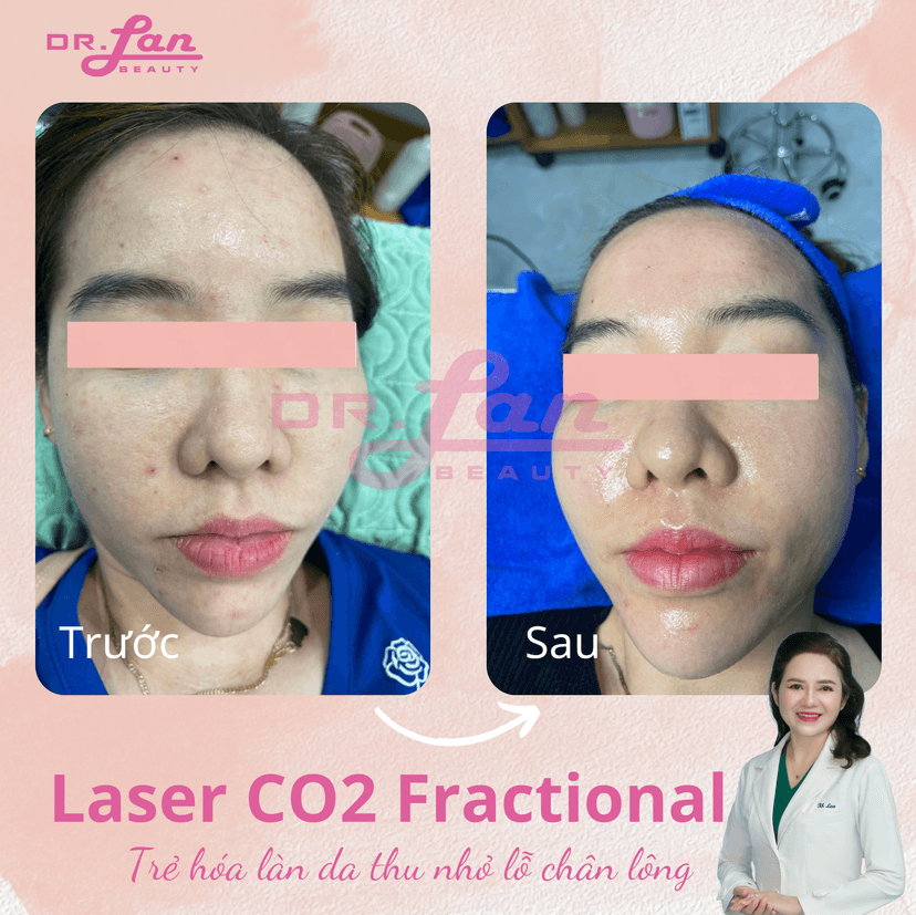 Sử dụng kem chống nắng