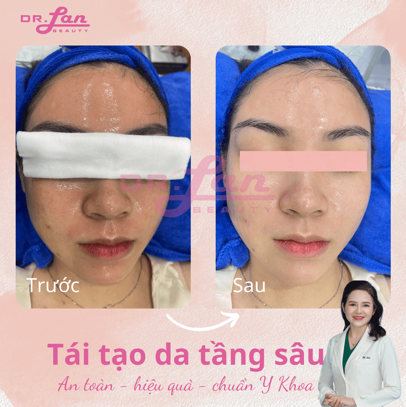 Sử dụng serum/kem dưỡng da hàng ngày